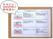 インプラント